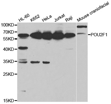 POU2F1 / OCT1 Antibody - Western blot analysis of extracts of various cell lines, using POU2F1 antibody.