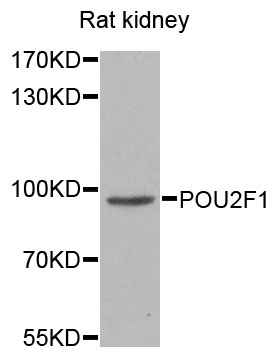 POU2F1 / OCT1 Antibody - Western blot analysis of extracts of rat kidney, using POU2F1 antibody at 1:1000 dilution. The secondary antibody used was an HRP Goat Anti-Rabbit IgG (H+L) at 1:10000 dilution. Lysates were loaded 25ug per lane and 3% nonfat dry milk in TBST was used for blocking. An ECL Kit was used for detection and the exposure time was 15s.