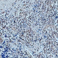 POU2F1 / OCT1 Antibody - Immunohistochemical analysis of 42278 staining in human tonsil formalin fixed paraffin embedded tissue section. The section was pre-treated using heat mediated antigen retrieval with sodium citrate buffer (pH 6.0). The section was then incubated with the antibody at room temperature and detected using an HRP conjugated compact polymer system. DAB was used as the chromogen. The section was then counterstained with hematoxylin and mounted with DPX.