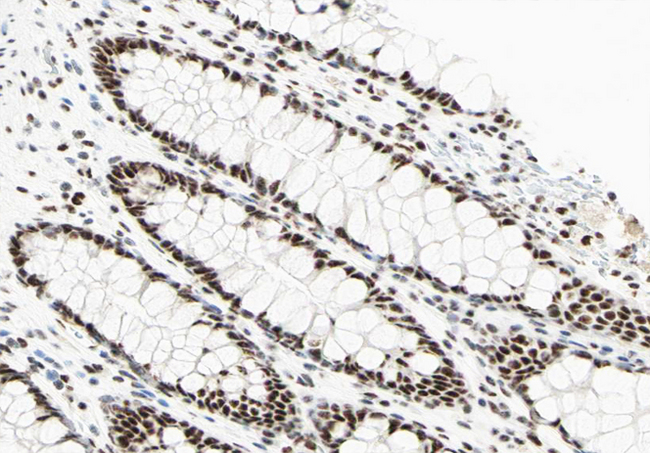 POU2F1 / OCT1 Antibody - 1:100 staining human colon tissue by IHC-P. The tissue was formaldehyde fixed and a heat mediated antigen retrieval step in citrate buffer was performed. The tissue was then blocked and incubated with the antibody for 1.5 hours at 22°C. An HRP conjugated goat anti-rabbit antibody was used as the secondary.