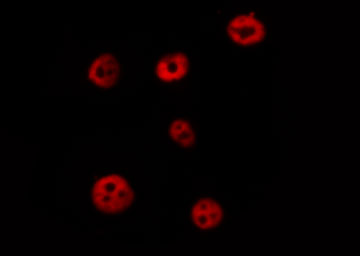 POU2F1 / OCT1 Antibody - Staining HeLa cells by IF/ICC. The samples were fixed with PFA and permeabilized in 0.1% Triton X-100, then blocked in 10% serum for 45 min at 25°C. The primary antibody was diluted at 1:200 and incubated with the sample for 1 hour at 37°C. An Alexa Fluor 594 conjugated goat anti-rabbit IgG (H+L) Ab, diluted at 1/600, was used as the secondary antibody.