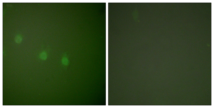 POU2F2 / OCT2 Antibody - Immunofluorescence analysis of COS7 cells, using OCT2 Antibody. The picture on the right is blocked with the synthesized peptide.