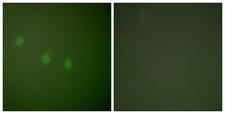 POU2F2 / OCT2 Antibody - Immunofluorescence analysis of COS7 cells, using OCT2 Antibody. The picture on the right is blocked with the synthesized peptide.