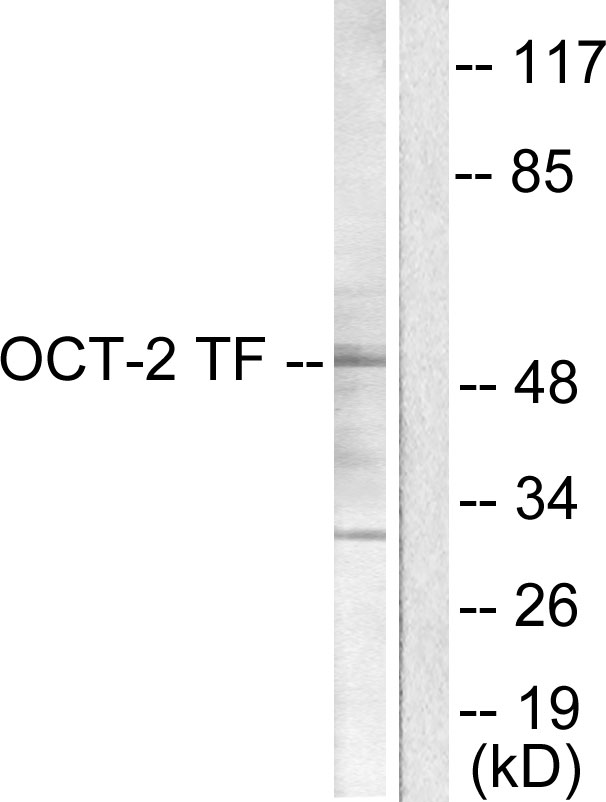POU2F2 / OCT2 Antibody - Western blot analysis of lysates from COS7 cells, using OCT2 Antibody. The lane on the right is blocked with the synthesized peptide.
