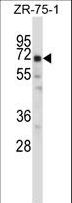 POU2F2 / OCT2 Antibody - POU2F2 Antibody western blot of ZR-75-1 cell line lysates (35 ug/lane). The POU2F2 antibody detected the POU2F2 protein (arrow).