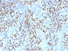 POU2F2 / OCT2 Antibody - IHC testing of FFPE human lymph node with OCT-2 antibody (clone OCT2/2136). HIER: boil tissue sections in pH6, 10mM citrate buffer, for 10-20 min followed by cooling at RT for 20 min.