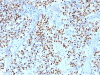 POU2F2 / OCT2 Antibody - IHC testing of FFPE human lymph node with OCT-2 antibody (clone OCT2/2136). HIER: boil tissue sections in pH6, 10mM citrate buffer, for 10-20 min followed by cooling at RT for 20 min.