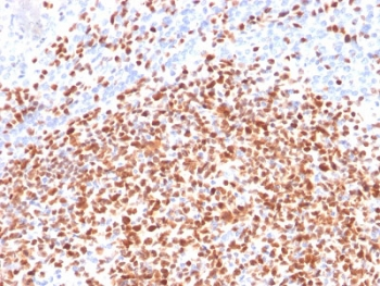 POU2F2 / OCT2 Antibody - IHC testing of FFPE human lymph node with OCT-2 antibody (clone OCT2/2137). HIER: boil tissue sections in pH6, 10mM citrate buffer, for 10-20 min followed by cooling at RT for 20 min.