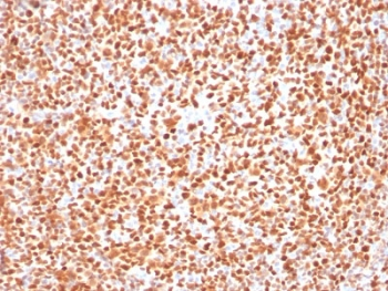 POU2F2 / OCT2 Antibody - IHC testing of FFPE human tonsil with OCT-2 antibody (clone OCT2/2137). HIER: boil tissue sections in pH6, 10mM citrate buffer, for 10-20 min followed by cooling at RT for 20 min.