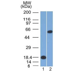 POU2F2 / OCT2 Antibody - Western blot testing of 1) partial recombinant protein and 2) human Daudi lysate with OCT-2 antibody (clone OCT2/2137). Expected molecular weight: isoforms from 43~62 kDa.