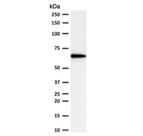 POU2F2 / OCT2 Antibody - Western blot testing of human Ramos lysate with OCT-2 antibody (clone PD2F2-1). Expected molecular weight: isoforms from 43~62 kDa.