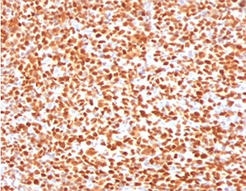 POU2F2 / OCT2 Antibody - IHC testing of FFPE human tonsil with OCT-2 antibody (clone PD2F2-1). HIER: boil tissue sections in pH6, 10mM citrate buffer, for 10-20 min followed by cooling at RT for 20 min.