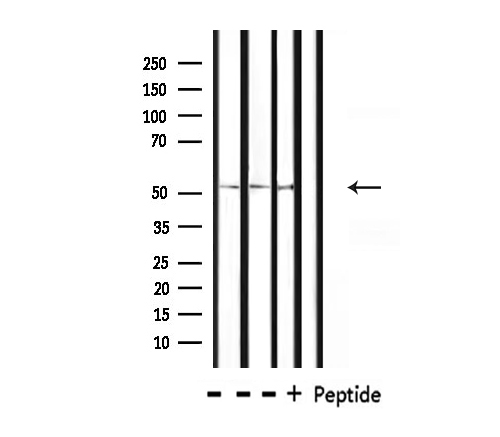 POU2F2 / OCT2 Antibody - Western blot analysis of extracts of HepG2, mouse spleen, rat liver tissue using OCT2 antibody. The lane on the right is treated with the antigen-specific peptide.