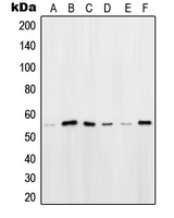 POU2F2 / OCT2 Antibody - Western blot analysis of OCT2 expression in HeLa (A); HEK293T (B); Ramos (C); K562 (D); Raji (E); NIH3T3 (F) whole cell lysates.