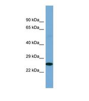 POU2F3 / PLA-1 Antibody - Western blot of Human Fetal Kidney. POU2F3 antibody dilution 1.0 ug/ml.  This image was taken for the unconjugated form of this product. Other forms have not been tested.