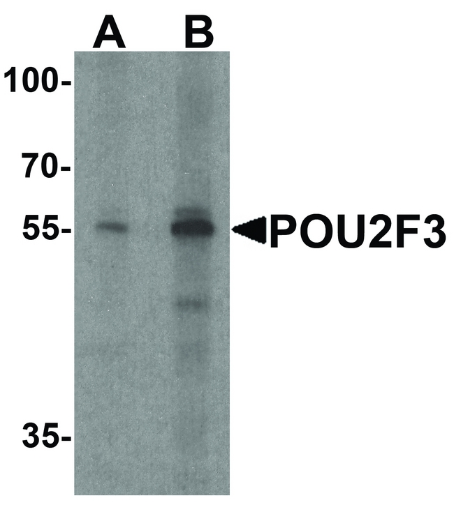 POU2F3 / PLA-1 Antibody - Western blot analysis of POU2F3 in SK-N-SH cell lysate with POU2F3 antibody at (A) 1 and (B) 2 ug/ml.