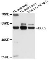 POU2F3 / PLA-1 Antibody - Western blot analysis of extracts of various cell lines, using POU2F3 antibody at 1:1000 dilution. The secondary antibody used was an HRP Goat Anti-Rabbit IgG (H+L) at 1:10000 dilution. Lysates were loaded 25ug per lane and 3% nonfat dry milk in TBST was used for blocking. An ECL Kit was used for detection and the exposure time was 5s.