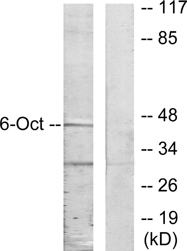 POU3F1 / OCT6 Antibody - Western blot analysis of lysates from A549 cells, using OCT6 Antibody. The lane on the right is blocked with the synthesized peptide.