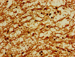POU3F1 / OCT6 Antibody - Immunohistochemistry image of paraffin-embedded human brain tissue at a dilution of 1:100