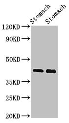 POU3F1 / OCT6 Antibody - Positive Western Blot detected in Rat stomach tissue, Mouse stomach tissue. All lanes: POU3F1 antibody at 3 µg/ml Secondary Goat polyclonal to rabbit IgG at 1/50000 dilution. Predicted band size: 46 KDa. Observed band size: 46 KDa