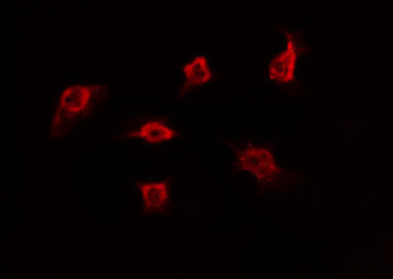 POU3F1 / OCT6 Antibody - Staining A549 cells by IF/ICC. The samples were fixed with PFA and permeabilized in 0.1% Triton X-100, then blocked in 10% serum for 45 min at 25°C. The primary antibody was diluted at 1:200 and incubated with the sample for 1 hour at 37°C. An Alexa Fluor 594 conjugated goat anti-rabbit IgG (H+L) Ab, diluted at 1/600, was used as the secondary antibody.