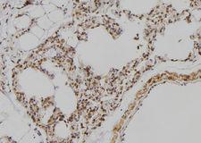 POU3F3 / BRN1 Antibody - 1:100 staining rat lung tissue by IHC-P. The sample was formaldehyde fixed and a heat mediated antigen retrieval step in citrate buffer was performed. The sample was then blocked and incubated with the antibody for 1.5 hours at 22°C. An HRP conjugated goat anti-rabbit antibody was used as the secondary.