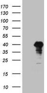 POU4F3 / BRN3C Antibody - HEK293T cells were transfected with the pCMV6-ENTRY control. (Left lane) or pCMV6-ENTRY POU4F3. (Right lane) cDNA for 48 hrs and lysed