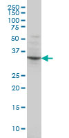 POU4F3 / BRN3C Antibody - POU4F3 monoclonal antibody (M01), clone 5B8 Western Blot analysis of POU4F3 expression in HeLa NE.
