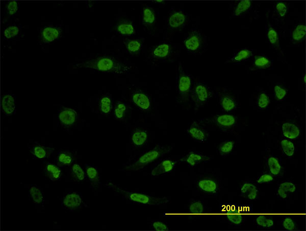 POU4F3 / BRN3C Antibody - Immunofluorescence of monoclonal antibody to POU4F3 on HeLa cell. [antibody concentration 10 ug/ml]
