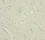POU4F3 / BRN3C Antibody - Immunohistochemistry of paraffin-embedded human brain tissue at dilution 1:100