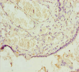 POU4F3 / BRN3C Antibody - Immunohistochemistry of paraffin-embedded human placenta tissue at dilution 1:100