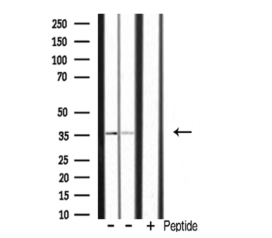 POU4F3 / BRN3C Antibody - Western blot analysis of extracts of various samples using POU4F3 antibody.