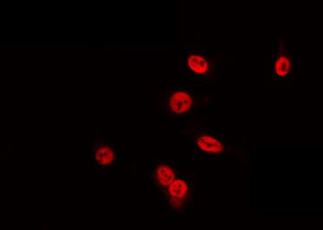 POU4F3 / BRN3C Antibody - Staining HuvEc cells by IF/ICC. The samples were fixed with PFA and permeabilized in 0.1% Triton X-100, then blocked in 10% serum for 45 min at 25°C. The primary antibody was diluted at 1:200 and incubated with the sample for 1 hour at 37°C. An Alexa Fluor 594 conjugated goat anti-rabbit IgG (H+L) Ab, diluted at 1/600, was used as the secondary antibody.