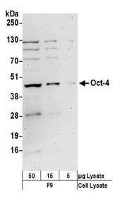 POU5F1 / OCT4 Antibody - Detection of mouse Oct-4 by western blot. Samples: Whole cell lysate (5, 15 and 50 µg) from F9 cells prepared using NETN lysis buffer. Antibodies: Affinity purified rabbit anti-Oct-4 antibody used for WB at 0.4 µg/ml. Detection: Chemiluminescence with an exposure time of 3 minutes.