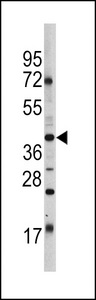 POU5F1 / OCT4 Antibody - Western blot of OCT3/4 Antibody (E125) in HL60 cell line lysates (35 ug/lane). OCT3/4 (arrow) was detected using the purified antibody.