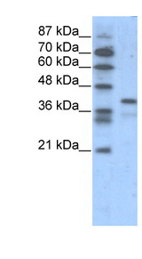 POU5F1 / OCT4 Antibody - POU5F1 / OCT4 antibody Western blot of Jurkat lysate. This image was taken for the unconjugated form of this product. Other forms have not been tested.