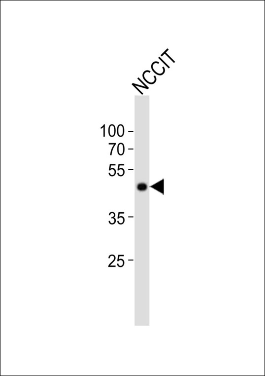 POU5F1 / OCT4 Antibody - Western blot of lysate from NCCIT cell line, using POU5F1 antibody diluted at 1:1000. A goat anti-rabbit IgG H&L (HRP) at 1:10000 dilution was used as the secondary antibody. Lysate at 20 ug.