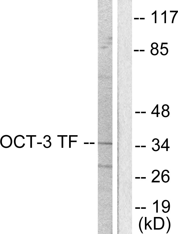 POU5F1 / OCT4 Antibody - Western blot analysis of lysates from HeLa cells, using OCT3 Antibody. The lane on the right is blocked with the synthesized peptide.