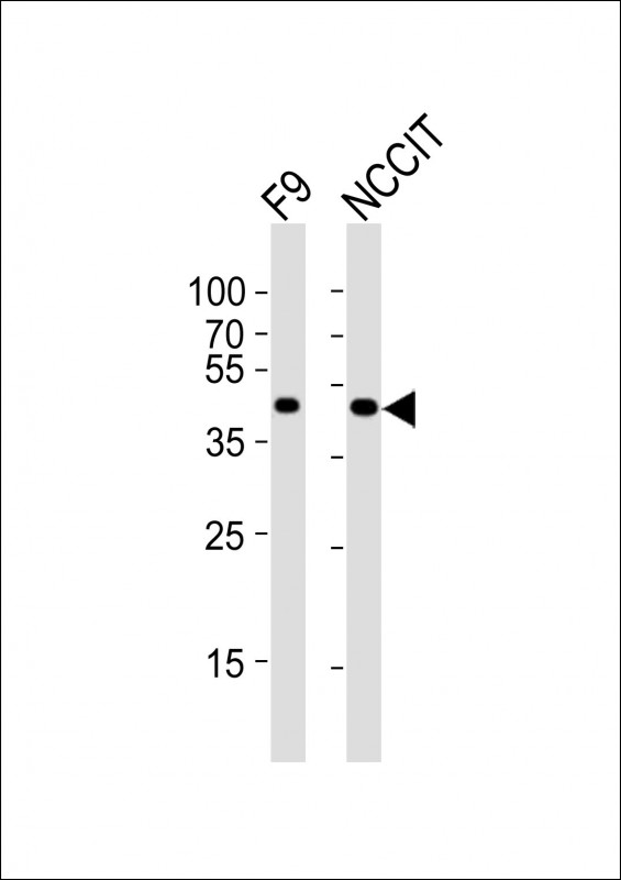 POU5F1 / OCT4 Antibody - All lanes : Anti-Pou5f1 Antibody at 1:4000 dilution Lane 1: F9 whole cell lysates Lane 2: NCCIT whole cell lysates Lysates/proteins at 20 ug per lane. Secondary Goat Anti-Rabbit IgG, (H+L), Peroxidase conjugated at 1/10000 dilution Predicted band size : 38 kDa Blocking/Dilution buffer: 5% NFDM/TBST.