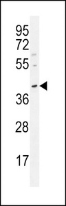POU5F1 / OCT4 Antibody - OCT3/4 Antibody (C279) western blot of MDA-MB231 cell line lysates (35 ug/lane). The OCT3/4 antibody detected the OCT3/4 protein (arrow).