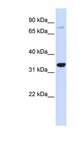 POU5F1 / OCT4 Antibody - POU5F1 / OCT4 antibody Western blot of 293T cell lysate. This image was taken for the unconjugated form of this product. Other forms have not been tested.
