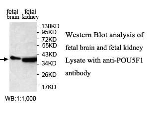 POU5F1 / OCT4 Antibody