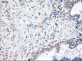 POU5F1 / OCT4 Antibody - IHC of paraffin-embedded Human endometrium tissue using anti-OCT4 mouse monoclonal antibody.