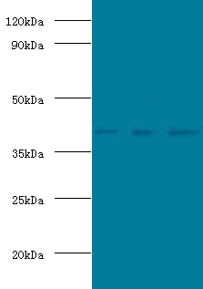 POU5F1 / OCT4 Antibody - Western blot of POU domain, class 5, transcription factor 1 antibody at 2 ug/ml lane 1: Jurkat whole cell lysate lane 2: HeLa whole cell lysate Lane 3: 293T whole cell lysate Secondary.  This image was taken for the unconjugated form of this product. Other forms have not been tested.