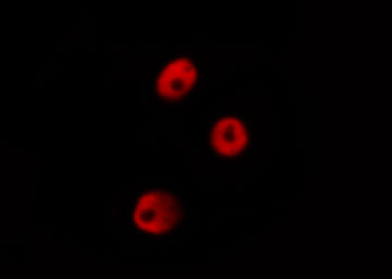 POU5F1 / OCT4 Antibody - Staining HeLa cells by IF/ICC. The samples were fixed with PFA and permeabilized in 0.1% Triton X-100, then blocked in 10% serum for 45 min at 25°C. The primary antibody was diluted at 1:200 and incubated with the sample for 1 hour at 37°C. An Alexa Fluor 594 conjugated goat anti-rabbit IgG (H+L) Ab, diluted at 1/600, was used as the secondary antibody.