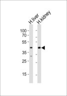 POU5F1B Antibody - Western blot of lysates from human liver, human kidney tissue (from left to right) with POU5F1B Antibody. Antibody was diluted at 1:1000 at each lane. A goat anti-rabbit IgG H&L (HRP) at 1:10000 dilution was used as the secondary antibody. Lysates at 20 ug per lane.