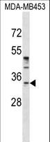 POU6F1 / BRN5 Antibody - POU6F1 Antibody western blot of MDA-MB453 cell line lysates (35 ug/lane). The POU6F1 antibody detected the POU6F1 protein (arrow).