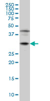 POU6F1 / BRN5 Antibody - POU6F1 monoclonal antibody (M01), clone 6H1 Western Blot analysis of POU6F1 expression in Jurkat.