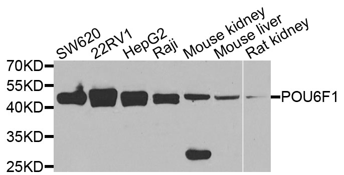 POU6F1 / BRN5 Antibody - Western blot analysis of extracts of various cells.