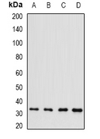 POU6F1 / BRN5 Antibody - Western blot analysis of Brn-5 expression in HepG2 (A); Raji (B); mouse liver (C); rat kidney (D) whole cell lysates.